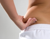 Compromisso com estilo de vida saudável é importante para bons resultados na Lipoaspiração Compromisso com estilo de vida saudável é importante para bons resultados na Lipoaspiração