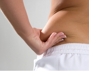 Compromisso com estilo de vida saudável é importante para bons resultados na Lipoaspiração